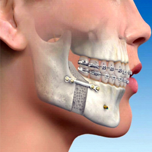 card-image